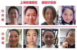 -上海玫瑰医疗美容医院