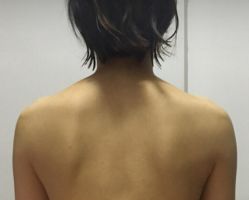 -深圳悦她医疗美容
