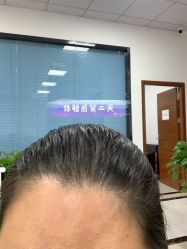 -章光101防脱养发荟