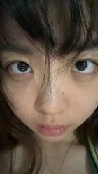 -成都西区医院整形美容