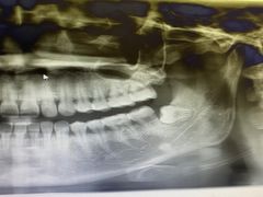 -泰康拜博口腔(世博园乐尔店)