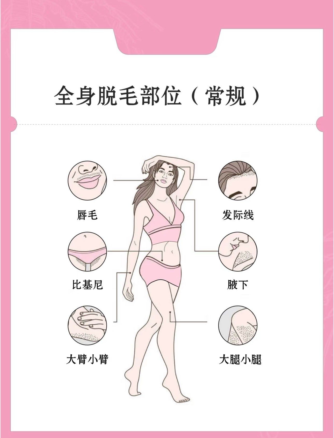 脱毛