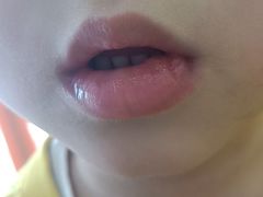 -极橙儿童齿科矫正中心(奥城店)