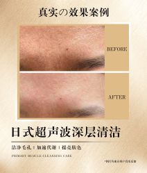 -POCO宝珂丽科技美肤