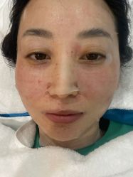 体验后-坤如玛丽·医疗美容中心