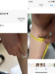 体验前-北京博泽医疗美容门诊部