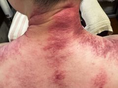 -沈师傅盲人按摩工作室(密三小区店)