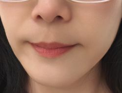 -TBL·痘肌·敏感肌·科技美肤中心
