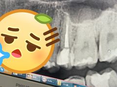 -咿呀口腔(光谷分院)