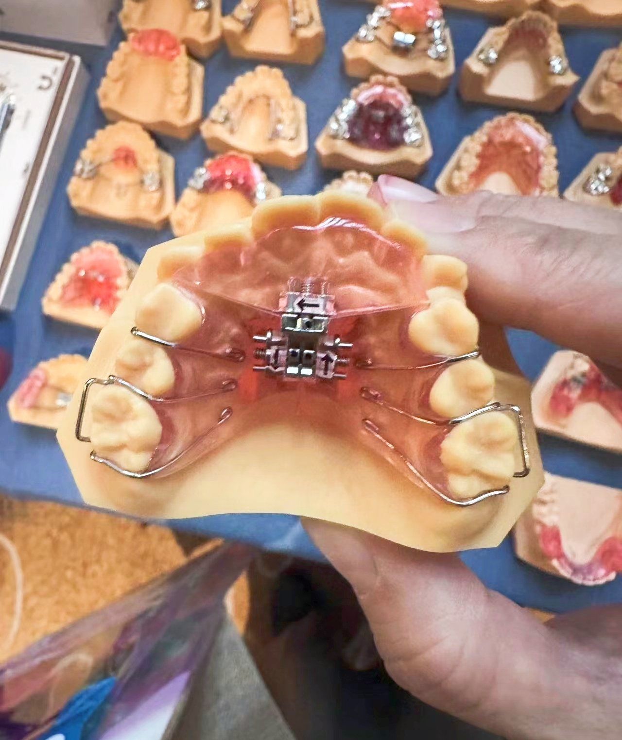 什么是儿童早期矫正?