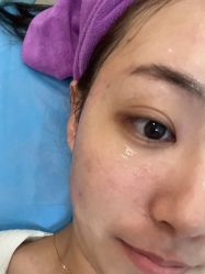 -北京米扬丽格医疗美容·联合丽格鼻整形中心