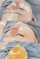-SKIN79皮肤管理中心