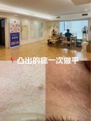 -清疣美疣·痣·斑净肤中心
