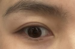 体验后-上海时光整形外科医院