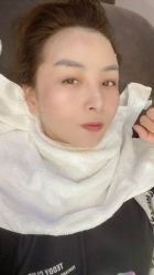 体验后-深圳美莱医疗美容医院