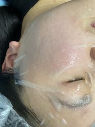 -长沙雅美医疗美容医院