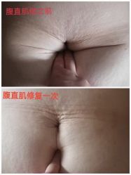 -安院长·产后恢复·徒手骨盆(先天下店)