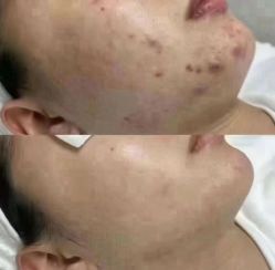 -Cream88颜皮肤管理中心