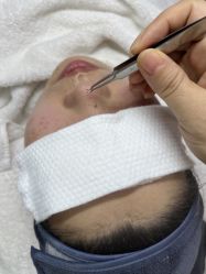 -安那般那皮肤年轻化ANAPANA