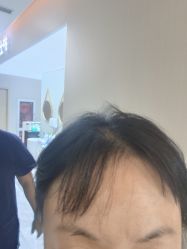 -More摩尔医美の注射线雕光电中心