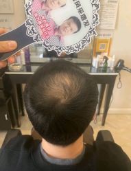 -唐风采假发补发定制