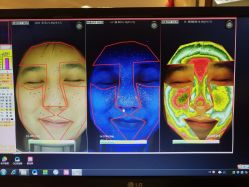 点击看大图 皮肤诊断-光SPA科技美肤