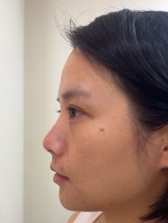 -长沙雅美医疗美容医院