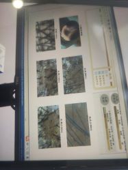 -大麦微针植发全国连锁