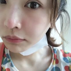 -美丽人生祛斑扁平疣汗管瘤中心