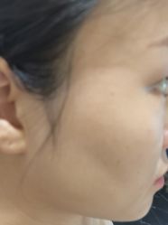 -美瑞莎创美医疗美容