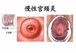 -邢台妇产医院