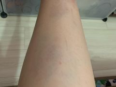 -合肥滨湖国家森林公园