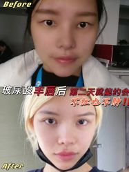 -上海玫瑰医疗美容医院