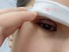 -宁波市眼科医院