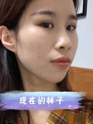 -新美荟医美·专注面部美学抗衰