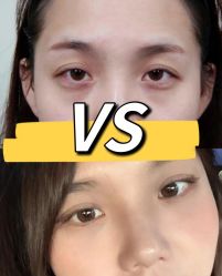 -天津健丽·去眼袋医疗美容机构