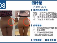 -体博士·疼痛调理·体态矫正·运动康复中心(大望路华贸店)