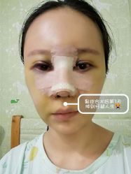 -素美医疗美容·西南眼鼻整形·修复基地