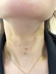 -厦门美莱整形美容医院