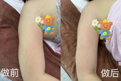 -Lily纤美·科技减脂中心