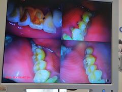 -瑞德口腔医院(白云旗舰院)