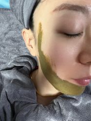 -北京豆豆博士专业祛痘