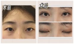 -素美医疗美容·西南眼鼻整形·修复基地
