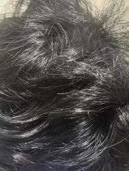 -碧莲盛·不剃发植发