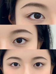 点击看大图 -杨益美学·野生眉半永久纹眉发际线