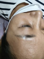 -痣清宫祛斑祛痣连锁店