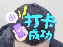 -大麦微针植发全国连锁