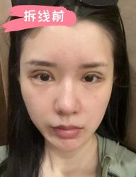 -素美医疗美容·西南眼鼻整形·修复基地