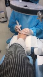 -派恩宜灰指甲鸡眼嵌甲手足癣