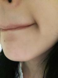 -咪咪比基尼脱毛专业店